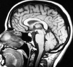 http://www.answers.com/topic/imaging-techniques